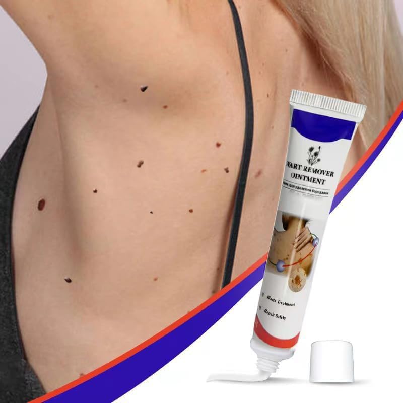 Fast-Acting Warts Remover Ointment – Natural & Painless Wart Treatment