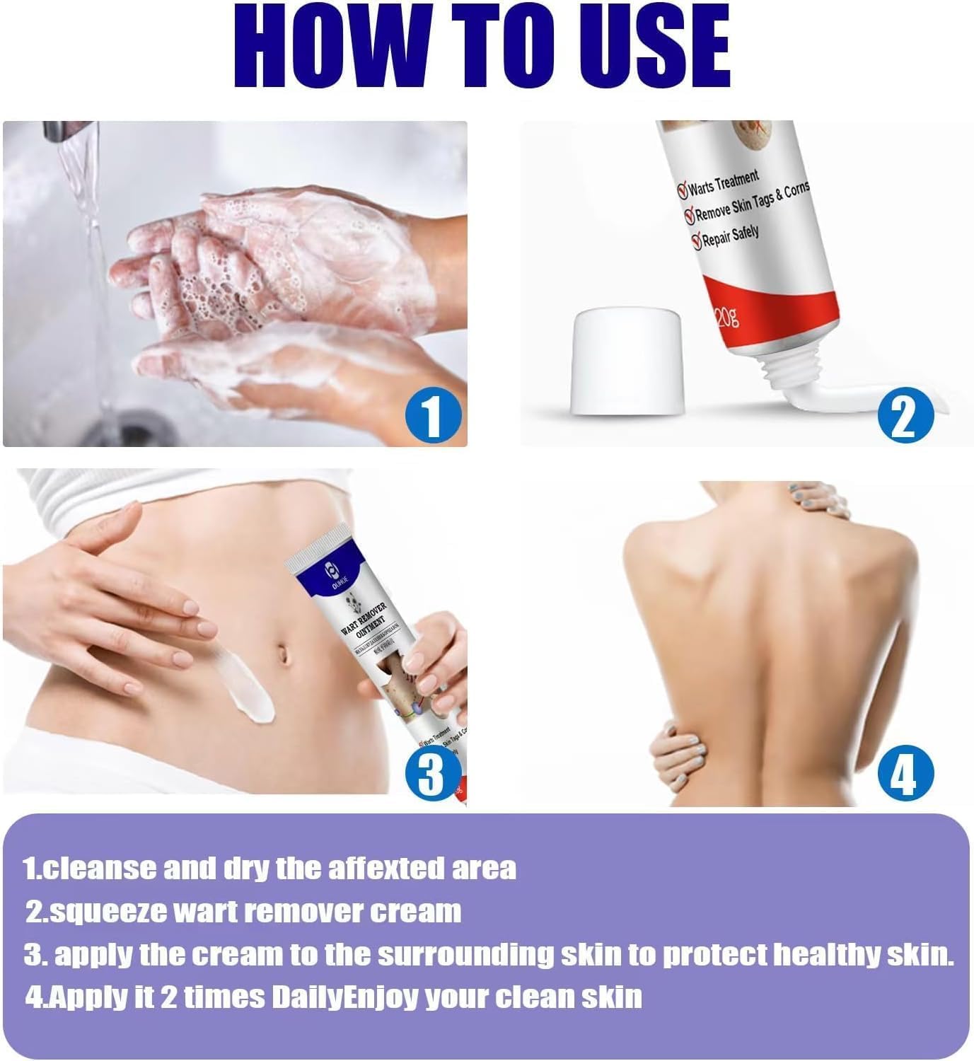 Fast-Acting Warts Remover Ointment – Natural & Painless Wart Treatment