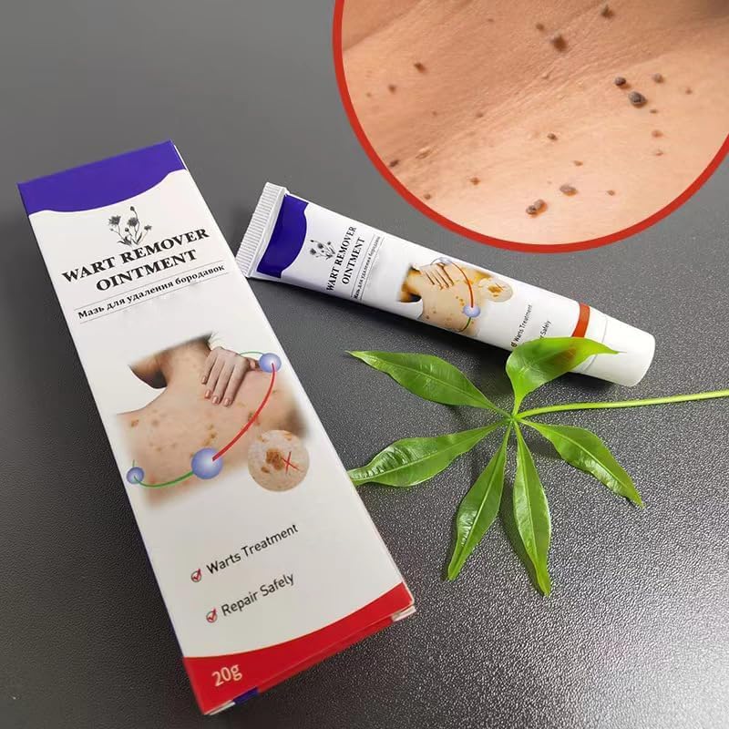 Fast-Acting Warts Remover Ointment – Natural & Painless Wart Treatment